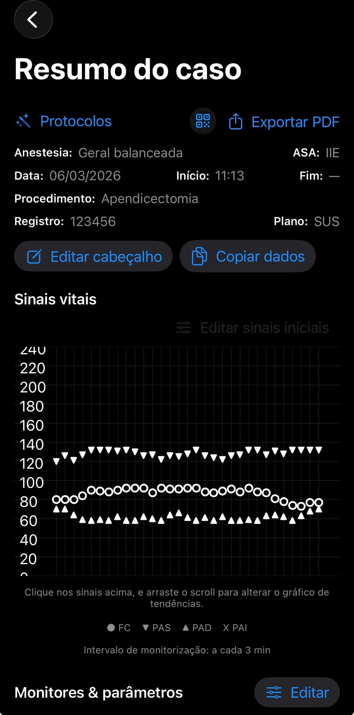 Demonstração do Anest+ em uso